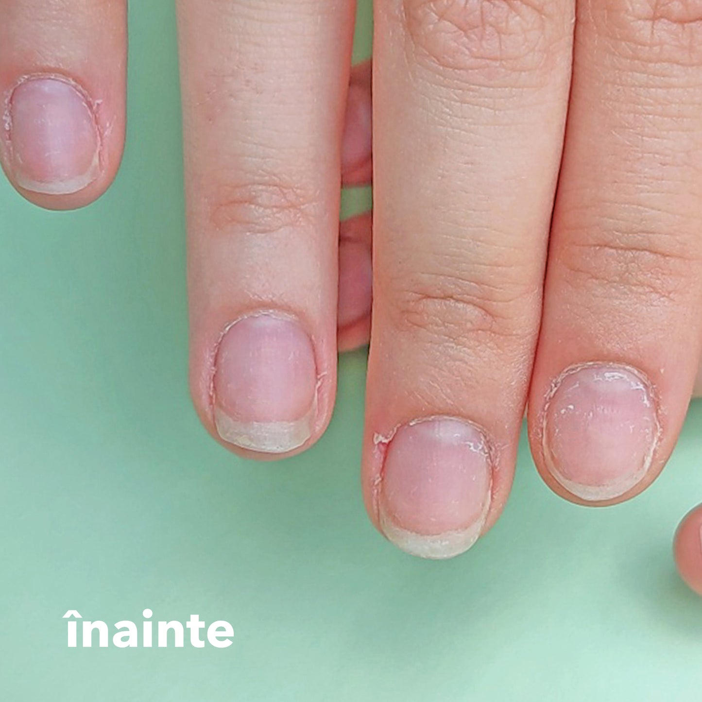 Magic Cuticle | Soluție îndepărtare cuticule