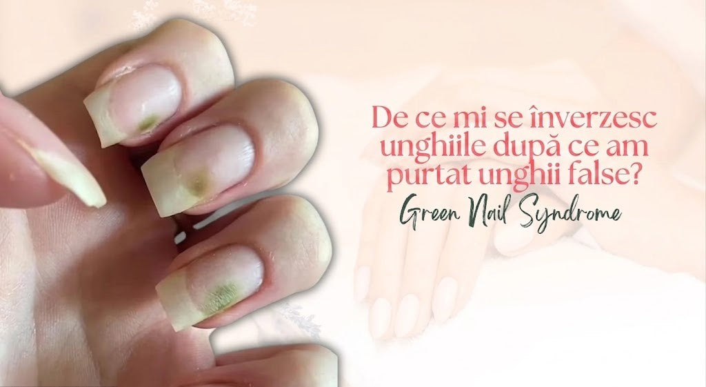 ,,Mucegai” pe unghii: Unghia verde dupa purtarea unghiilor false -  de ce apare si cum o poti preveni